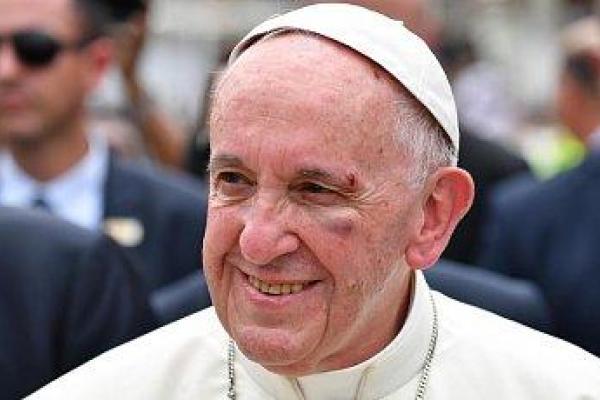 Рассеченная бровь и синяк на лице: как закончилась поездка Папы Римского в Колумбию