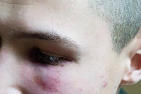 Штурм Октябрьского дворца в Киеве: хроника событий и последние новости Штурм Октябрьского дворца в Киеве: хроника событий и последние новости