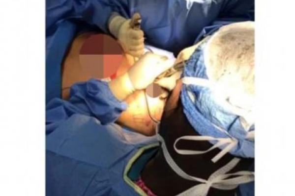 "Юбилейная" пластическая операция: "человек-Кен" Родриго Алвес решился на удаление костей "Юбилейная" пластическая операция: "человек-Кен" Родриго Алвес решился на удаление костей