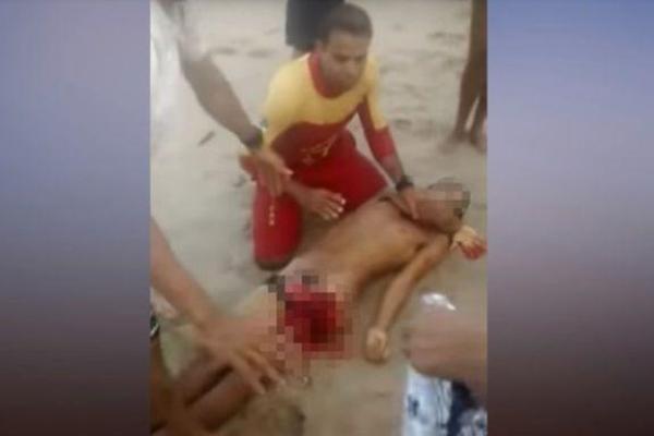 В Бразилии акула откусила купающемуся юноше половые органы (видео 18+)