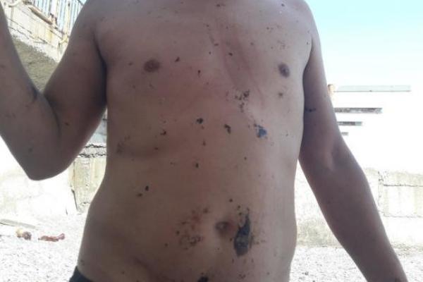 В Крыму внезапно почернело море: люди не могут купаться В Крыму внезапно почернело море: люди не могут купаться